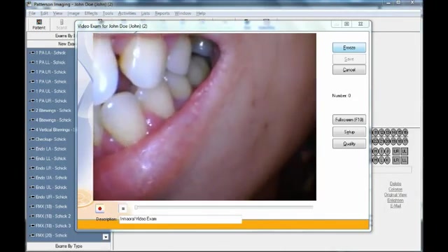 Dental Usb Software Download